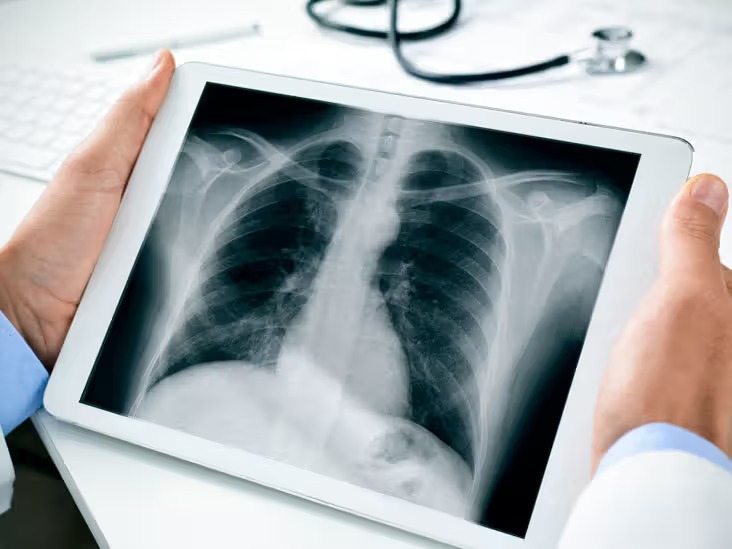 Chest X-ray in Rawalpindi