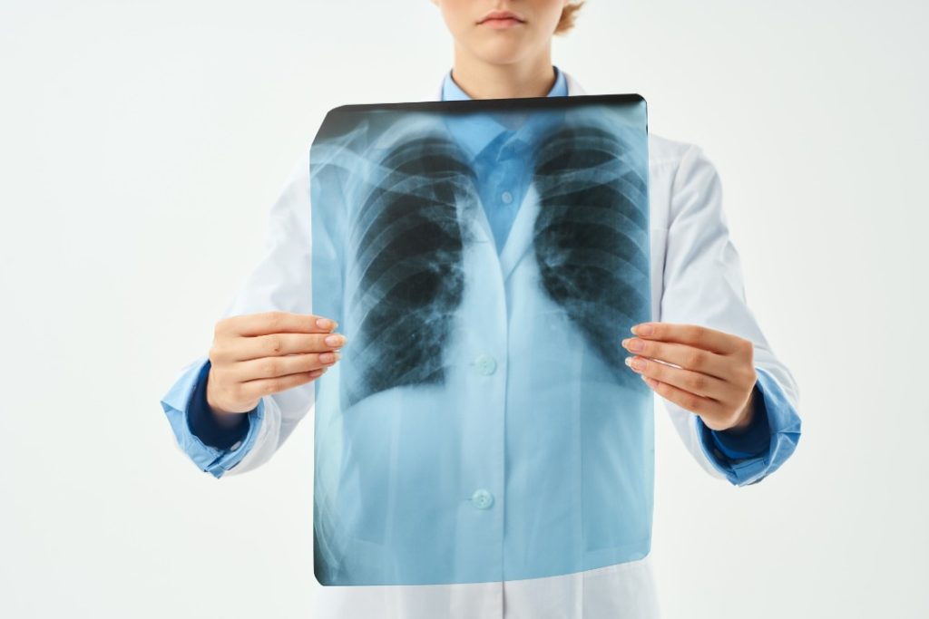 Chest X-ray in Rawalpindi